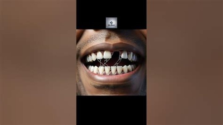 Can broken teeth grow back?