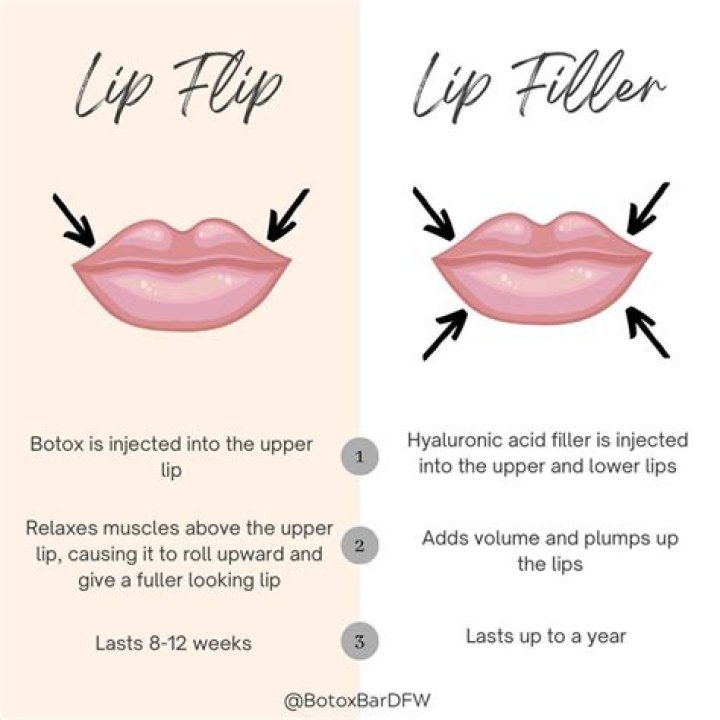 How long does it take for lip flip to work?