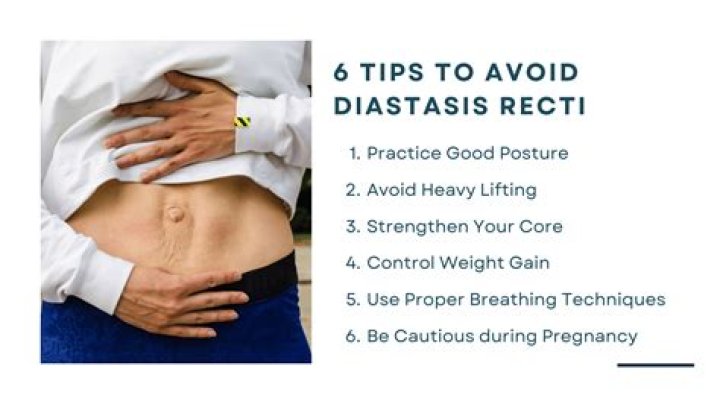 Is diastasis recti hard or soft?