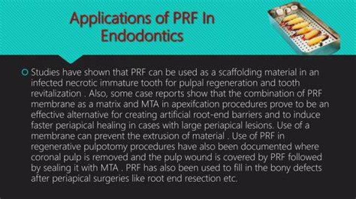 What can PRF funds be used for?