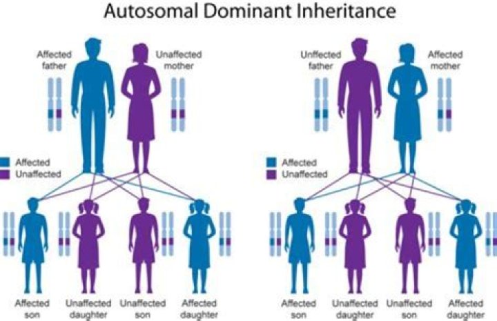 What is complex inheritance health issue?